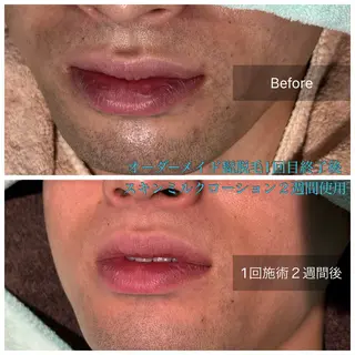 メンズ ReBorn  Lab所属・リボーン ラボのエステ・リラクイメージ