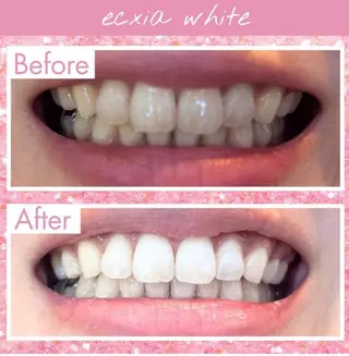 エクシアホワイト 💟fukaのその他イメージ