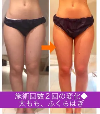 ロング カラー パーマ ヘアアレンジ メンズ キッズ ネイル マツエク・マツパ ‍痩身＆ボディ 結果出し🌟丹野のエステ・リラクイメージ