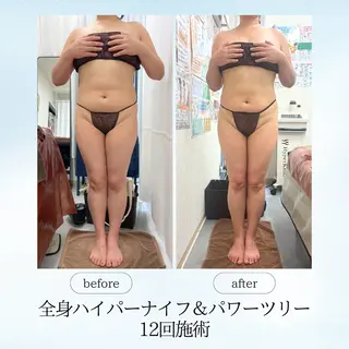 espresso,所属・《痩身、小顔専門店》 エスプレッソのエステ・リラクイメージ