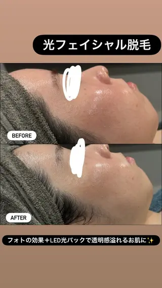 LiZA エステティックサロンのエステ・リラクイメージ