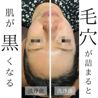 ハーブピーリング・毛穴ケア専門サロンSalon de LENA所属・ハーブピーリング 専門店/名古屋駅前店のその他イメージ