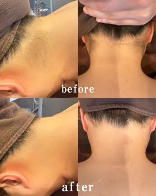 【痩身・脱毛】private salon Eclat所属・伊藤 心のエステ・リラクイメージ