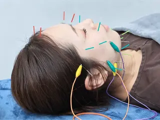 美容鍼・小顔矯正 FLOW 鍼灸整体院のその他イメージ