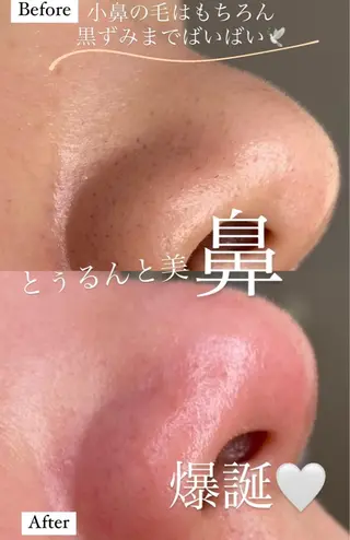 メンズ Hair atelier KEIZO所属・HBL AITO.のエステ・リラクイメージ