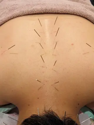 乃々鍼灸・整体院　表参道所属・乃々鍼灸整体院　植木 　【美容鍼/整体】のエステ・リラクイメージ