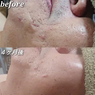 Rum Hinna ラムヒンナーのその他イメージ