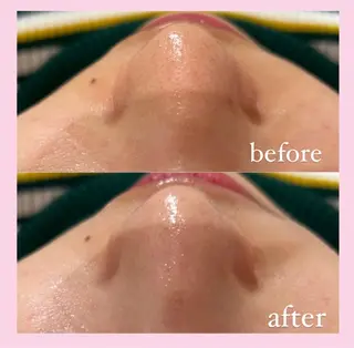 韓国肌管理専門店　White labo 宝塚店所属・有川 凜のエステ・リラクイメージ