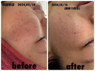 ÉMIA ✴︎のエステ・リラクイメージ