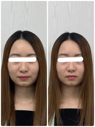 美容鍼×小顔矯正 ×美容整体　浜川泰仁のエステ・リラクイメージ