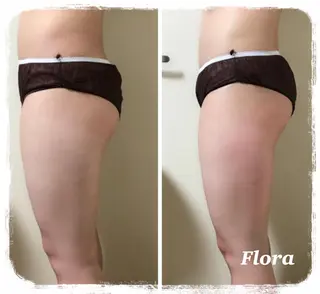 温活痩身エステ Floraのエステ・リラクイメージ