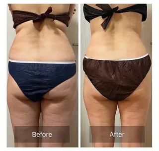 本気で痩せたい方へ 痩身専門サロンのエステ・リラクイメージ