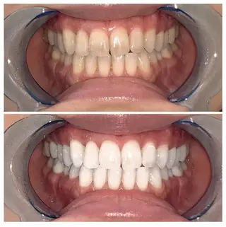 カラー メンズ マツエク・マツパ ネイル ヘアアレンジ パーマ キッズ アイブロウ ロング ライトビューティー 銀座本店のエステ・リラクイメージ