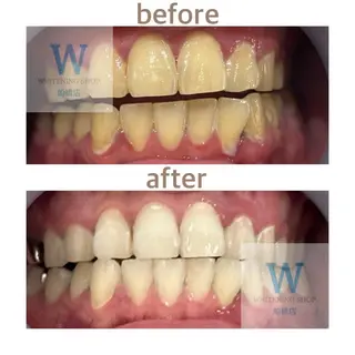 ホワイトニング ショップ船橋店🦷のエステ・リラクイメージ