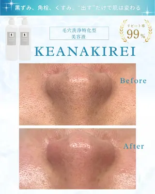 Liam《美肌管理/ 3D小顔/脂肪ケア》のエステ・リラクイメージ