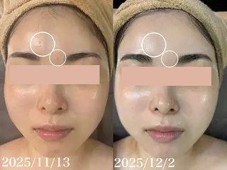 WHITE AQUA 北千住店のエステ・リラクイメージ