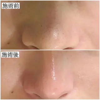 Luralïy hair kitakyushu所属・Luralïy ルーラリーのエステ・リラクイメージ