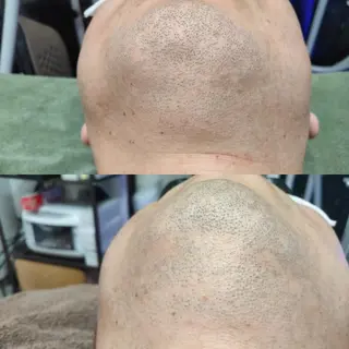 メンズ 武 藤のエステ・リラクイメージ