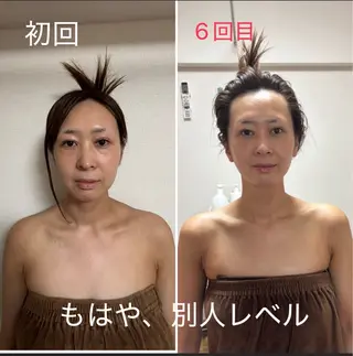 透明感の肌Lino malieのエステ・リラクイメージ