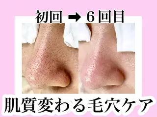 アイラッシュ&フェイシャルサロン ベアトリーチェ所属・医療提携美容サロン Beatriceのエステ・リラクイメージ