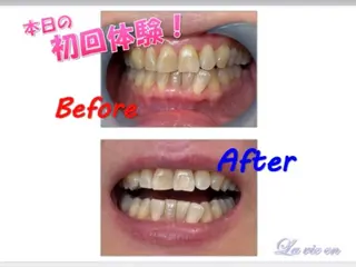 セルフホワイトニングサロン　ラヴィアン所属・ホワイトニングサロン La vie enのその他イメージ