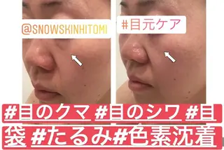 ニキビ/肌質改善専門 Snow skinのエステ・リラクイメージ