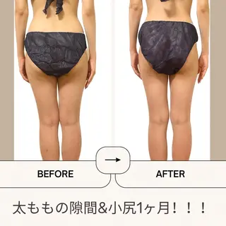 Welina  Pono beauty salon所属・加藤 美有のエステ・リラクイメージ