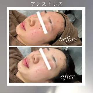 🦋美肌サロン. maho🦋のエステ・リラクイメージ