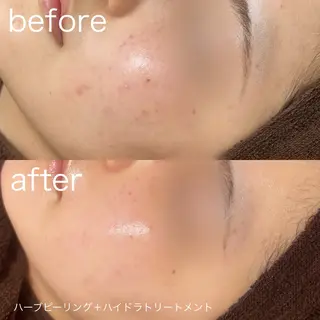 lulula ricoのエステ・リラクイメージ