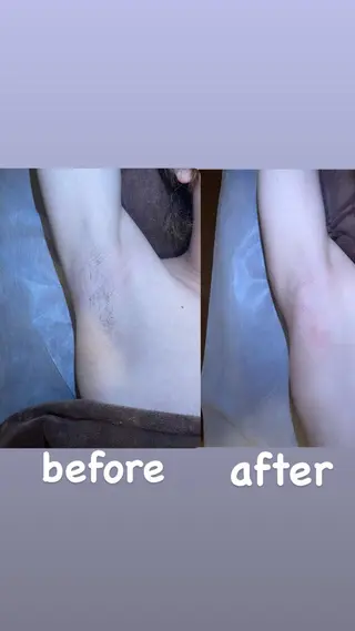 メンズ眉毛ITSUK Iメンズ専門　新宿の眉毛・アイブロウイメージ