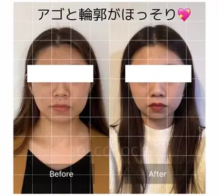 小顔と ヘッドスパのお店のエステ・リラクイメージ