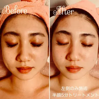 透明感の肌Lino malieのエステ・リラクイメージ