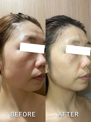 堀江リンパマッサージ 小顔×美肌×バストのエステ・リラクイメージ