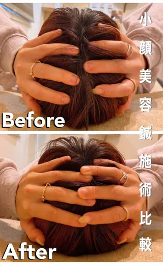 鍼灸整骨院Refine所属・鍼灸 Refineのその他イメージ