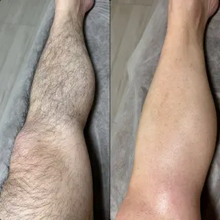 六本木脱毛andS 店長Sachiのエステ・リラクイメージ