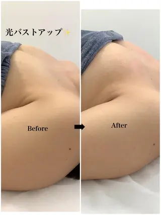 🩵Tatsumi Kana🩵のエステ・リラクイメージ