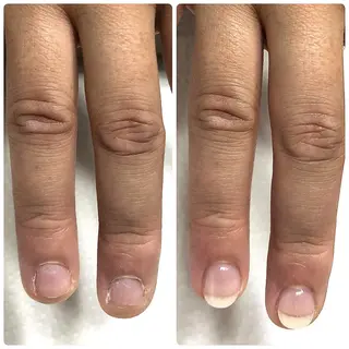 深爪矯正専門ネイルサロンエルナ所属・深爪矯正専門 ネイルサロンエルナのネイルデザイン