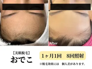 Belle White所属・本格痩身＊肌質改善＊ BelleWhiteのエステ・リラクイメージ