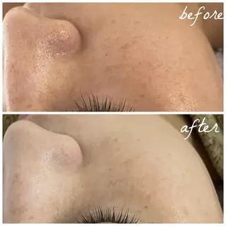 メンズ メナード岐阜茜部 杉浦のエステ・リラクイメージ