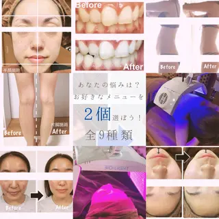 KalanDiva〜 ｶﾗﾝﾃﾞｨｰﾊﾞ〜のエステ・リラクイメージ