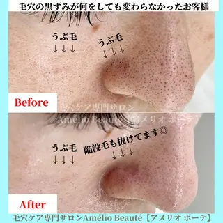 毛穴ケア専門サロン Amélio Beauté所属・毛穴ケア専門サロン アメリオボーテのその他イメージ