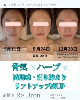 毛穴ケア くすみ肌 ハーブピーリングのエステ・リラクイメージ