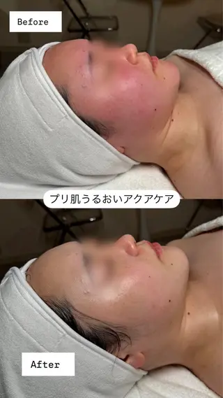 韓国肌管理🫧LDM 🫧Junnaのエステ・リラクイメージ