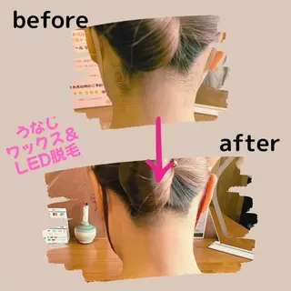 韓国系ピーリング & 脱毛サロン　松本のエステ・リラクイメージ