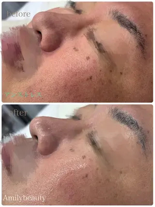 Amilybeauty所属・Amily beauty 毛利のその他イメージ