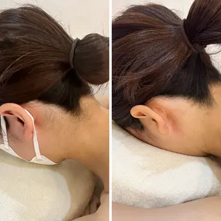 うなじ脱毛/美肌脱毛 LABELのエステ・リラクイメージ