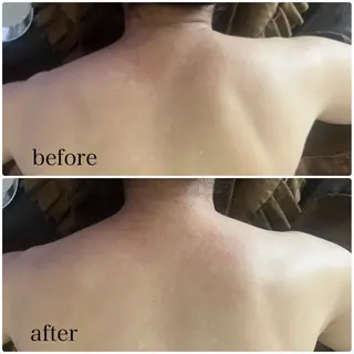 アロマ･美容鍼･カッ ピング「麗」鍼灸院のエステ・リラクイメージ