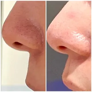 É LINDA所属・E LINDAのネイルデザイン