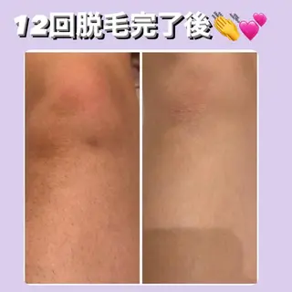 ULULU上野店所属・ULULU 上野店のエステ・リラクイメージ