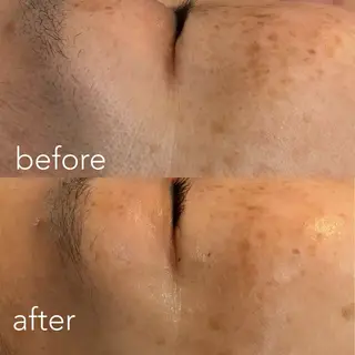 エステティックサロン Liente(リアンテ)所属・Hashimoto .のエステ・リラクイメージ